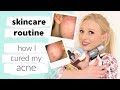 My full skin care routine (& how I CURED my acne)