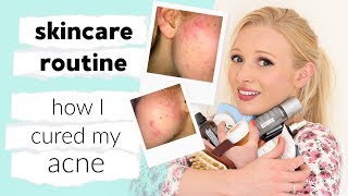 My full skin care routine (&amp; how I CURED my acne)