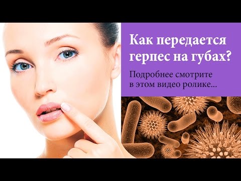 Ты ЭТО должен УВИДЕТЬ! Как передаётся герпес на губах? ШОК!