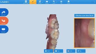 Launca  training #15 Introduce the function of real time soft tissue removal screenshot 5