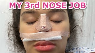 MY 3rd NOSE JOB SURGERY STORY!!