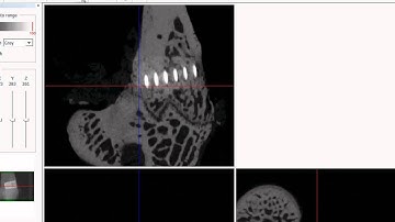 Bruker microCT training video: Introduction to dataviewer