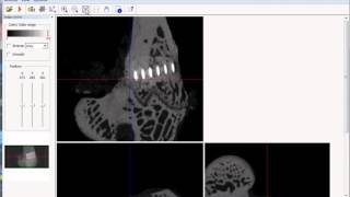 Bruker microCT training video: Introduction to dataviewer