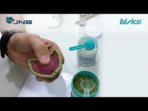 Оформление краев индивидуальной ложки для функционального оттиска при полном съемном протезировании