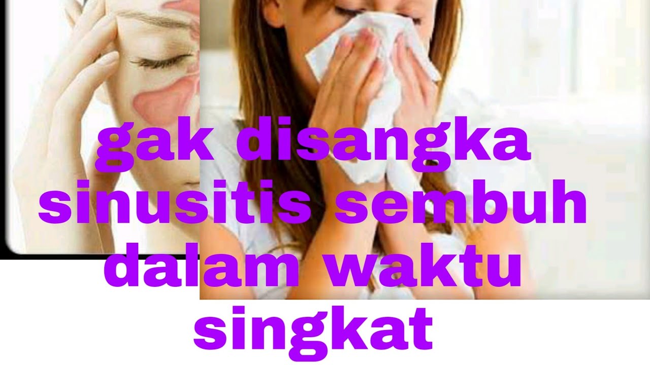 Cara mengobati sinusitis