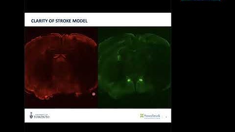 Feindel Virtual Brain and Mind Seminar at The Neuro presents Maged Goubran