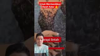 Terapi Lintah Gaes 😀#trending #shorts