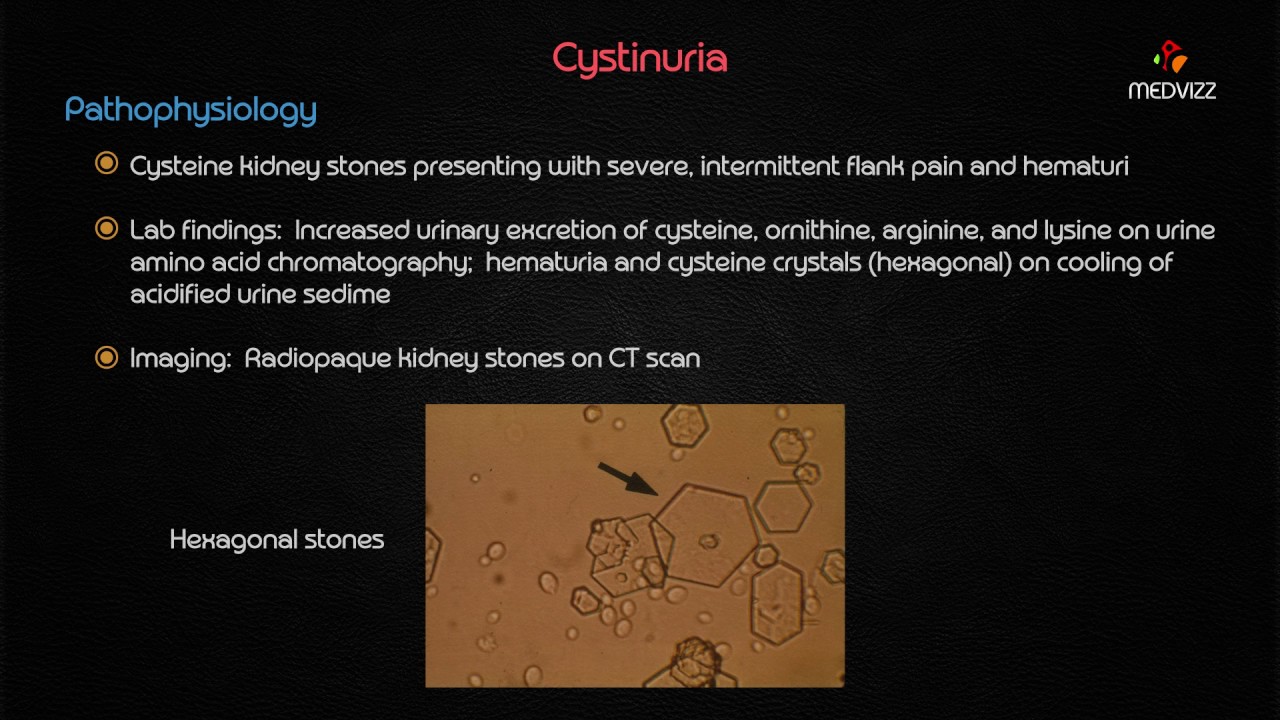 Cystinuria - Usmle Step 1 Biochemstry Webinar Based Lecture