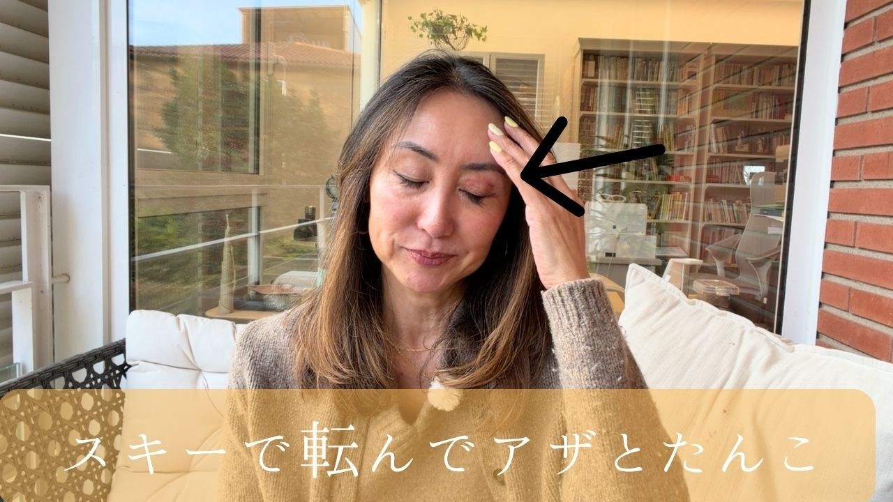 スキーで転んで宿で詐欺られそうになる｜アレルギー意外なものが。。