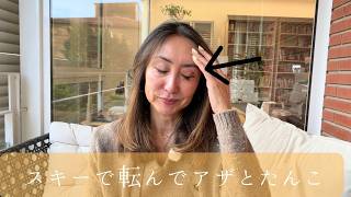 スキーで転んで宿で詐欺られそうになる｜アレルギー意外なものが。。