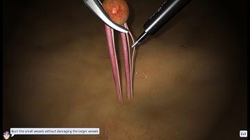 Basic Skills_2018: Fine Dissection