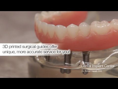 What Are Some Ways The Harrell Dental Implant Center Uses Surgical What Are Some Ways The Harrell Dental Implant Center Uses Surgical Guides