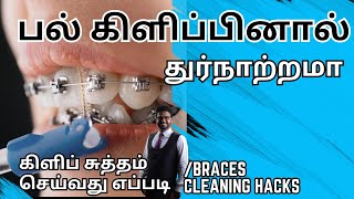 பல் கிளிப் அணிந்தவர்கள் கண்டிப்பாக செய்ய வேண்டியவை/𝐇𝐨𝐰 𝐭𝐨 𝐜𝐥𝐞𝐚𝐧 𝐛𝐫𝐚𝐜𝐞𝐬 𝐢𝐧 𝐭𝐚𝐦𝐢𝐥