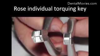 Practical wire bending tips in contemporary orthodontics for ideal case finishing