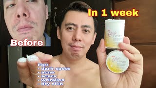 In 1 Week Uno Magic Cream Moisturizer For Acne & Scar With Glutathione, Collagen, Vitamin E Review