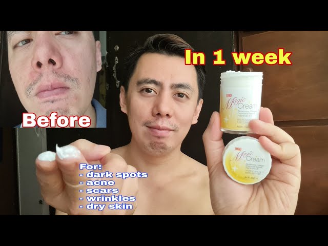 IN 1 WEEK | UNO MAGIC CREAM MOISTURIZER FOR ACNE & SCAR WITH GLUTATHIONE, COLLAGEN, VITAMIN E REVIEW