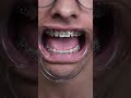 the world's LARGEST toothbrush vs. braces 😵