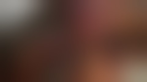 22 Segmental Resections Caudate Hepatectomy, Segment 1