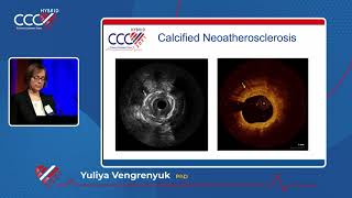 Intravascular Imaging and Yellow III Trial - Yuliya Vengrenyuk, PhD