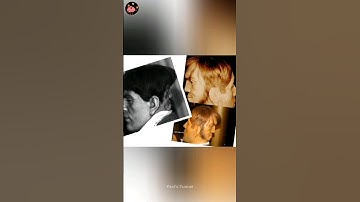 EdWard MorDake Born With Tow Faces | #shorts
