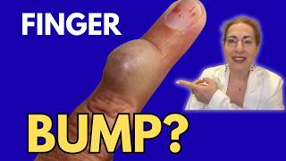 Before You Pop That Finger Bump... Watch This!