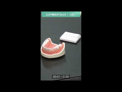 クリアフィル® ユニバーサルボンド Quickを使用したCAD/CAM冠のセメント接着ステップ動画