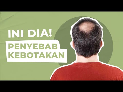 Video: Cara Menumbuhkan Rambut Panjang Sebagai Lelaki (dengan Gambar)