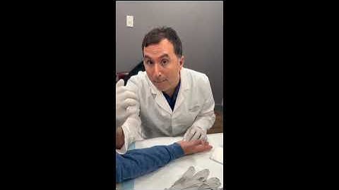 Xiaflex Injection for Dupuytren