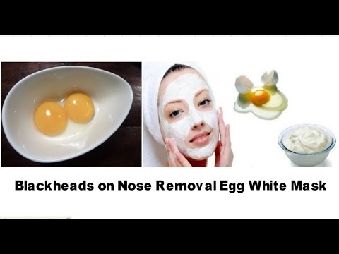 blackheads-on-nose-removal-|-egg-white-mask-|-blackhead-removal-on-nose