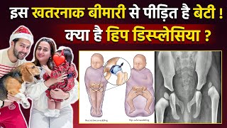 Varun Dhawan Daughter Disease Hip Developmental Dysplasia कय ह, Reason, Symptoms And Treatment