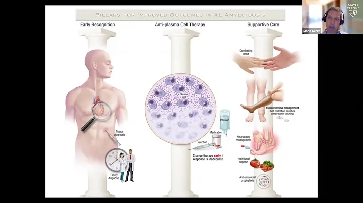 AL Amyloidosis Overview by Dr. Morie Gertz