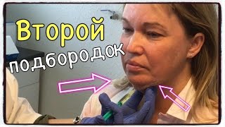 Второй ПОДБОРОДОК. Как УБРАТЬ ВТОРОЙ ПОДБОРОДОК. МЕЗОТЕРАПИЯ. Липолитики. Мастеркласс Е.Ранневой(Второй подбородок это проблема, котрая тяжело поддается коррекции, но современные разработки нам помогают..., 2016-11-06T20:09:02.000Z)