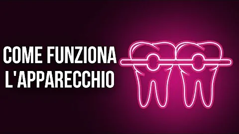 Quanto costa la macchinetta per i denti?