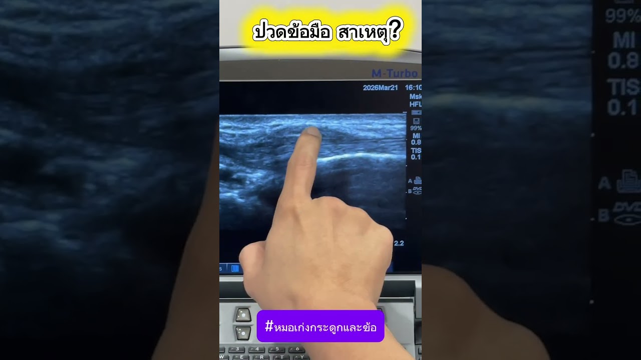 ปวดข้อมือ สาเหตุ?