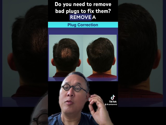 Do you need to remove bad plugs to fix them?