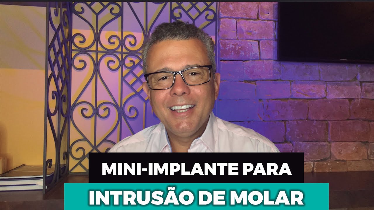 MINI-IMPLANTE PARA INTRUSÃO DE MOLAR - QUANTO DE FORÇA DEVO COLOCAR?