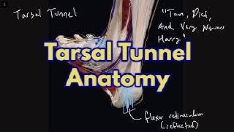 Tarsal Tunnel Anatomy - Tom, Dick, And Very Nervous Harry