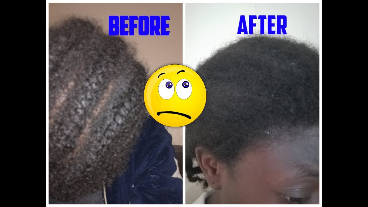 OLD BRAIDS 5 MONTH CORNROW TAKE DOWN!!!!| UK NATURAL