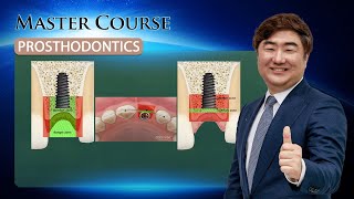 [Master Course - PROSTHODONTICS] Complications of Implants in Aesthetic Region screenshot 2