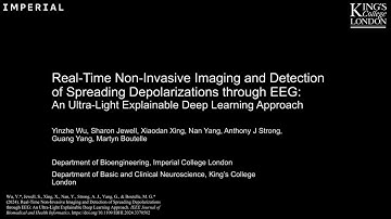 Real-Time Non-Invasive Imaging and Detection of Spreading Depolarizations through EEG