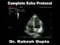A  complete echo study Dr Rakesh Gupta
