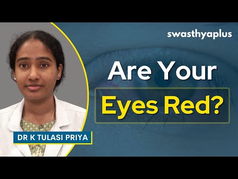 Redness in Eyes | Symptoms & Treatment | Dr K Tulasi Priya