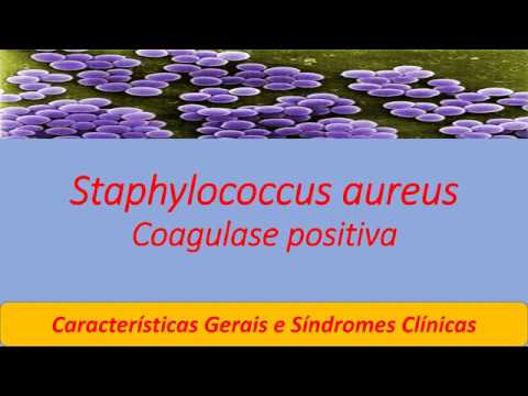 Vídeo: Staphylococcus Aureus Em Bebês Nas Fezes - Sintomas E Métodos De Tratamento De Staphylococcus Aureus, Conselho Do Parasitologista