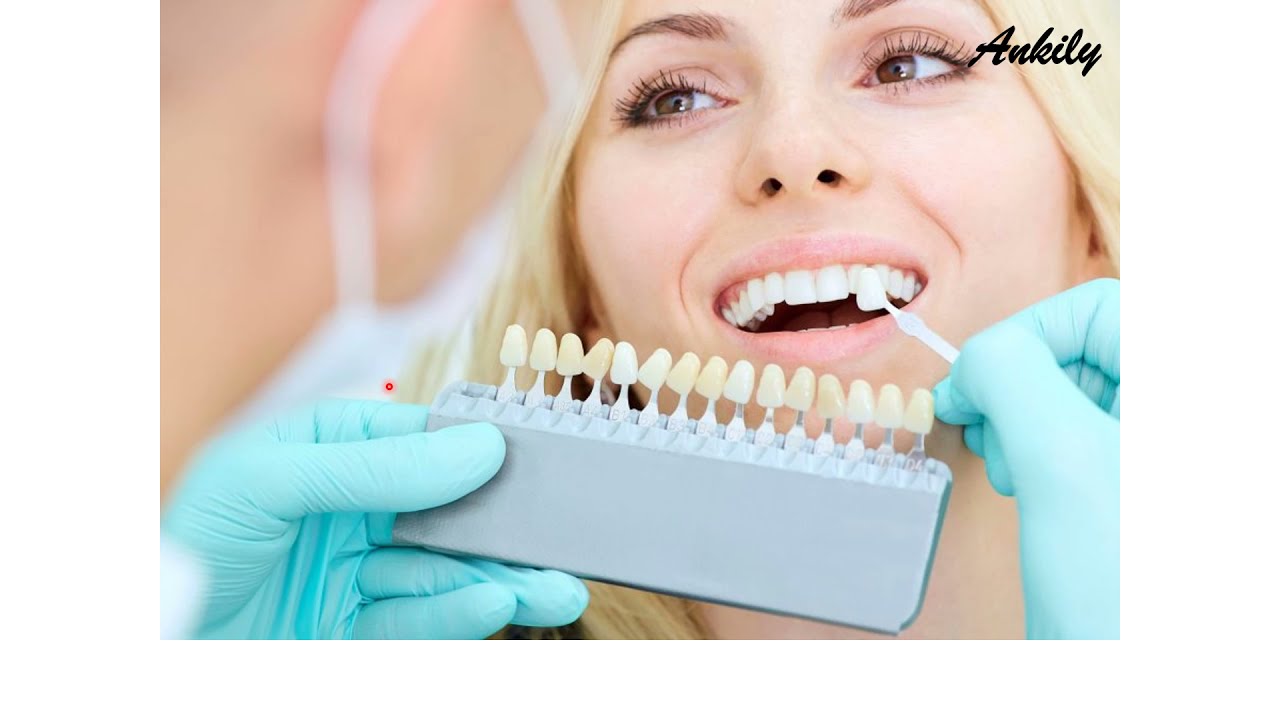 Enamel presentation part 1 (Shamel & Ankily)