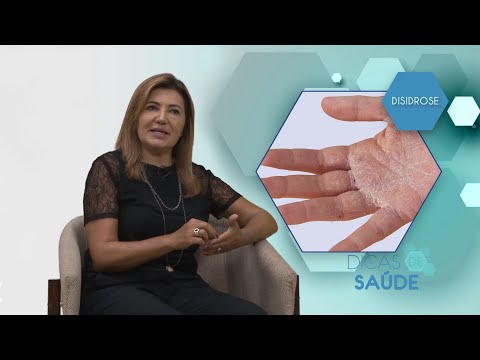 Vídeo: Eczema Disidrótico Nos Dedos - Sintomas E Tratamento