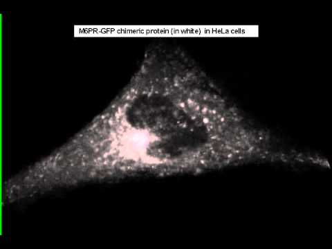 M6PR GFP in HeLa cell