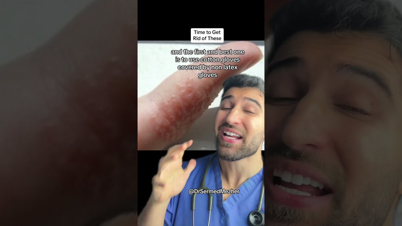 This Is What Causes Those Annoying Bumps On Your Fingers Dry
