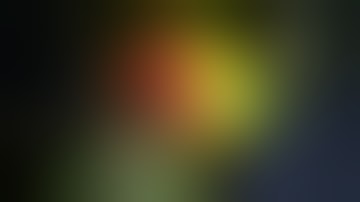 Total Knee Replacement Surgery Video | Conformis