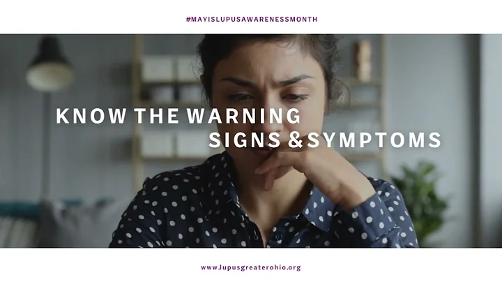 Someone You Know Has Lupus