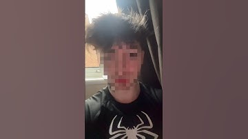 Snapchat No Media Upload Solution 2025!